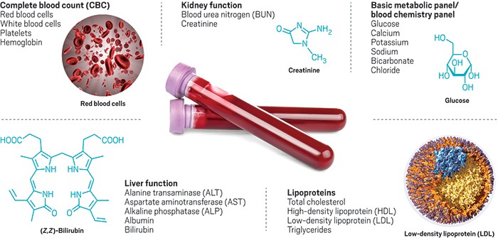 blood testing | understanding your pets blood work | lab test | blood chemistries | blood sample