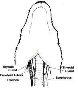 thyroid glands | hypothyroidism occurs